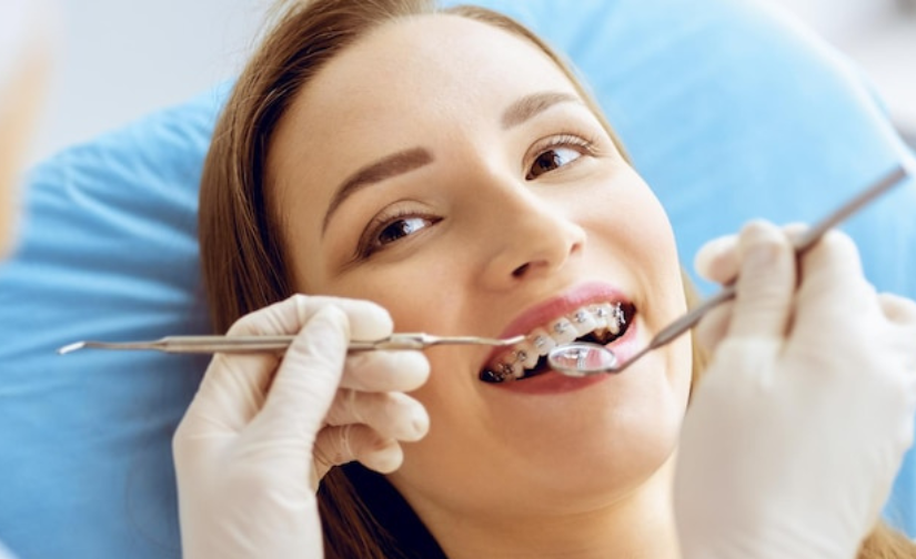 BENEFITS OF INVISALIGN BRACES, WHY YOU SHOULD START YOUR INVISALIGN TREATMENT IN 2023